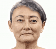 熱(rè)瑪吉5代Thermage FLX——風(fēng)靡娛樂圈抗衰神器