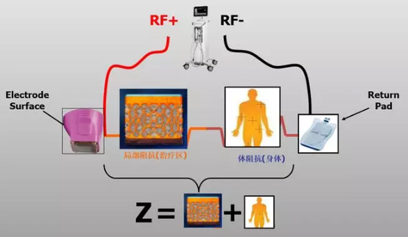 熱(rè)瑪吉5代Thermage FLX——風(fēng)靡娛樂圈抗衰神器