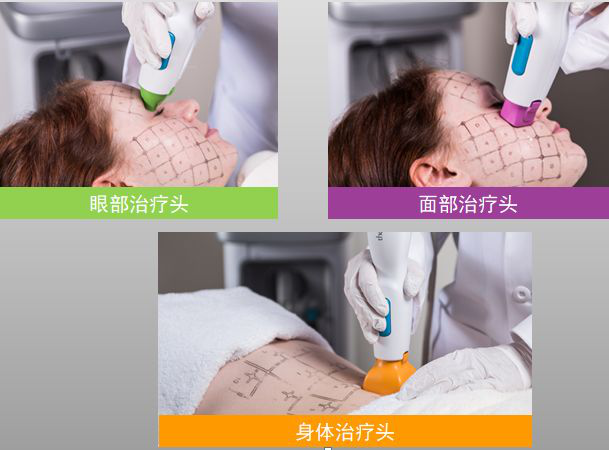 熱(rè)瑪吉5代Thermage FLX——風(fēng)靡娛樂圈抗衰神器